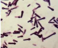 The bacilli are 2mm x 0.5mm in size and usually occur singly although occasionally in chains. Clostridium Tetani Flashcards Quizlet