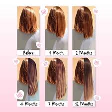 Hair growth after 3 months after surgery the transplanted hair goes into a resting phase. Compare Prices For Hairburst Across All Amazon European Stores