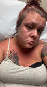 How painful is a lumbar puncture