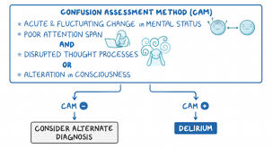 Image result for Confusion Assessment Method
