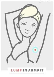 Painful Lump In Armpit Causes Symptoms Natural Treatments My Blog Armpit Lump Natural Treatments Armpits