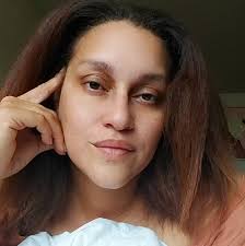 Why are my watermelon leaves turning yellow?