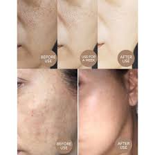 China Ailke Arabic Face Kojic Acid Remove Dark Spots Skin Melanin Whitening Cream China Whitening Cream And Skin Lightening Cream Price
