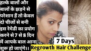 Homemade new shampoo base super fast hair growth अपने बालो को झड़ने से रोके  लबा घना मोटा बनाए 7दिन