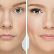 THE BEST 10 Medical Spas near BEDFORD, NY 10506