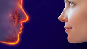 Hauterkrankung Rosacea Pickel Mit 30 Gesuendernet Ratgeber Fur Gesundheit Medizin Und Krankheiten