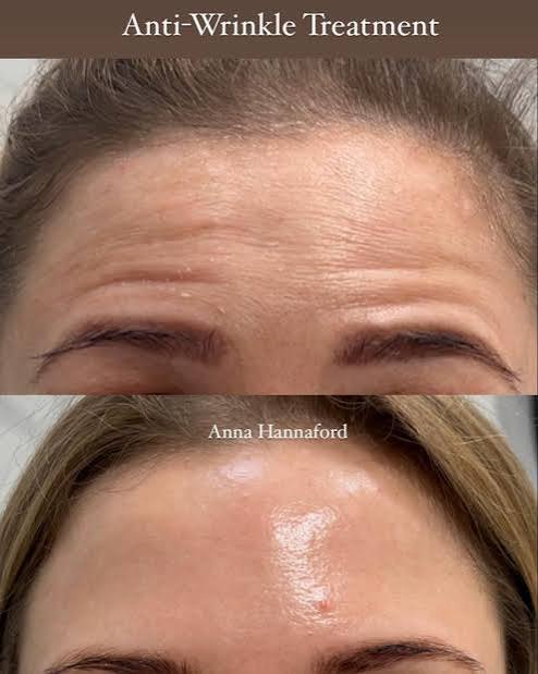 Professional practitioner consulting adult patient in modern London aesthetic clinic