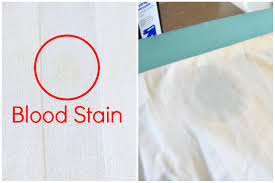 This is because the sodium hypochlorite in the chlorine bleach will overpower the hydrogen peroxide, essentially. How To Remove Dried Set In Blood Stains From Clothes