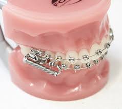 If you recently got your braces, then the experience can undoubtedly be painful and difficult to deal with for the first few days. Greatsydneysmiles