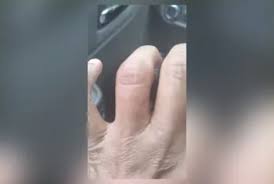 Ladrão morde motorista de táxi para roubar aliança perto de batalhão da PM no Rio