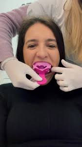 Mastering Alginate Impressions in Orthodontics