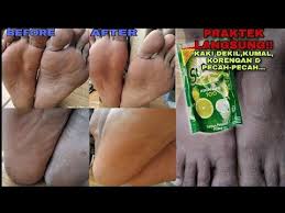 Kaki Dekil Kusam Korengan Pecah2 Langsung Cerah Mulus Seketika Youtube Di 2020 Perawatan Kulit Produk Perawatan Kulit Kaki