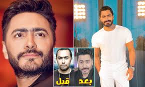 تامر حسني قبل وبعد التجميل في 10 لقطات،العمليات حولته لنسخة من مطرب شهير -  مشاهير
