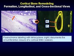 The spongy and compact bone tissue in the cross section of a skull bone. Bone Histology And Histopathology For Clinicians A Primer