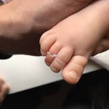 The changes in your penis size can be sudden and fast. Hair Tourniquets