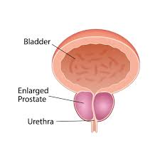 Image result for Prostate Anatomy