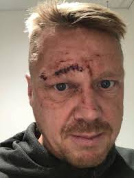 Sentencing adjourned for Barrow woman who brutally smashed glass in  ex-boyfriend's face