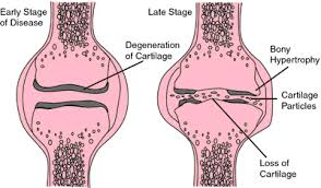 Cartilage Medical Terms Body Tissues Medical Dictionary