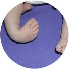 Play baby hazel games at y8.com. Kinderfuss Priv Doz Dr Christof Radler