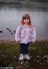 Teenager dies after surgery to correct sunken hollow in her chest