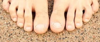 Pin On Podiatry