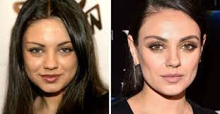 Ahora verás las siguientes situaciones en las que cada uno de estos pacientes han conseguido su objetivo de tener un rostro más perfilado y fino, olvidándose de las mejillas redondeadas. Bichectomia Antes Y Despues De Las Famosas Que Se Sometieron A Esta Cirugia Vix