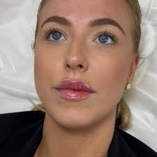 RUSSIAN LIPS using my personal technique made with special micro needles  please note russian lips are suitable only