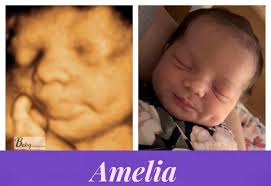 Cheeks💖 & Dimples✨ Congratulations