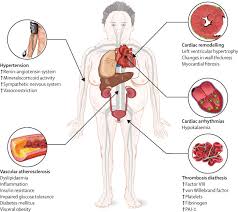 Complications Of Cushing S Syndrome State Of The Art The Lancet Diabetes Endocrinology