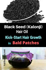 Black Seed Kalonji Hair Oil Kick Start Hair Growth In Bald Patches Hair Buddha Bald Hair Growth Hair Oil Hair Remedies For Growth