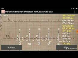 Ecg Reader Free Apps On Google Play