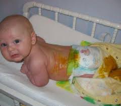 сколько должен спать ребенок в 2 месяца на ив Ponos U Grudnichka Kak Raspoznat Chto Delat Chto Dat Malyshu Ot Ponosa Detskaya Poliklinika 3