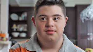 Canadian Down Syndrome Society When Do Babies With Down Syndrome Learn To Talk Down syndrome can affect how a person looks and thinks, and it's sometimes linked with other health problems, as well. when do babies with down syndrome learn