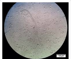 Image result for Strongyloides