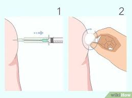 Never inject in the arm ( deltoids ). How To Give A B12 Injection 15 Steps With Pictures Wikihow