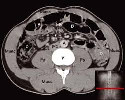 Microscopic anatomy of skeletal muscle. Abdominal Ct Anatomy Radiology Key