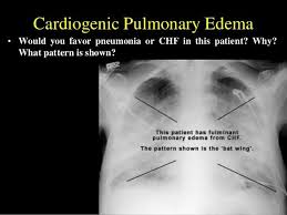 Pin On Radiology