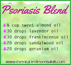 Diy Essential Oil Blend For Psoriasis En 2020 Psoriasis Le Psoriasis Probleme De Peau