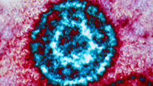 Virus particles in cultured lymphoblasts. Unterschatzter Erreger Das Epstein Barr Virus Br24