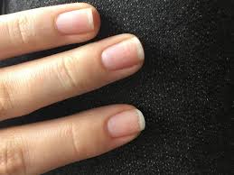 Maybe you would like to learn more about one of these? Que Significan Las Manchas Blancas En Las Unas