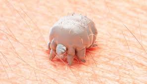 Image result for scabies on genitals