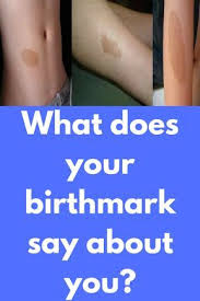 Birthmark On Leg Meaning What Does Your Birthmark Say About You What Does A Birthmark On Your Bottom Mean Birthmarks On Buttocks May Be Of Different Co Birthmark Sayings Mark Meaning