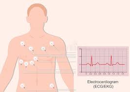 Image result for Electrocardiogram