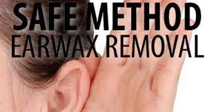 How To Clean Your Ears Complete Guide To Removing Ear Wax Ear Wax Removal Ear Cleaning Ear Wax