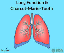 Hnf Wants To Help Our Inspire Members Get Answers To Questions Related To Charcot Marie Tooth One Topic That Has Been Addressed Is Teeth Diseases Lunges Teeth