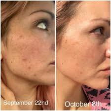 Anti-aging serum with natural ingredients