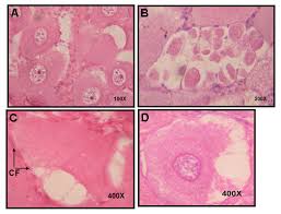 We did not find results for: Ovocitos Atresicos A Oi Atresicos En Estadio De Inicio Del Desarrollo Download Scientific Diagram