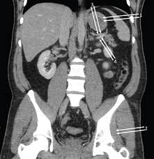This anatomy section promotes the use of the terminologia anatomica, the international standard of anatomical nomenclature. Abdomen And Pelvis Book Chapter Iopscience
