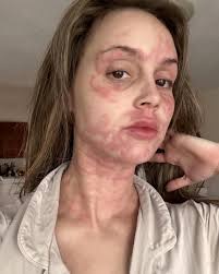 Secret Lives of Mormon Wives' Mikayla Hopes for Illness 'Answers'