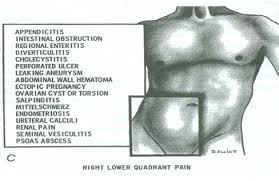 abdominal pain คือ hip